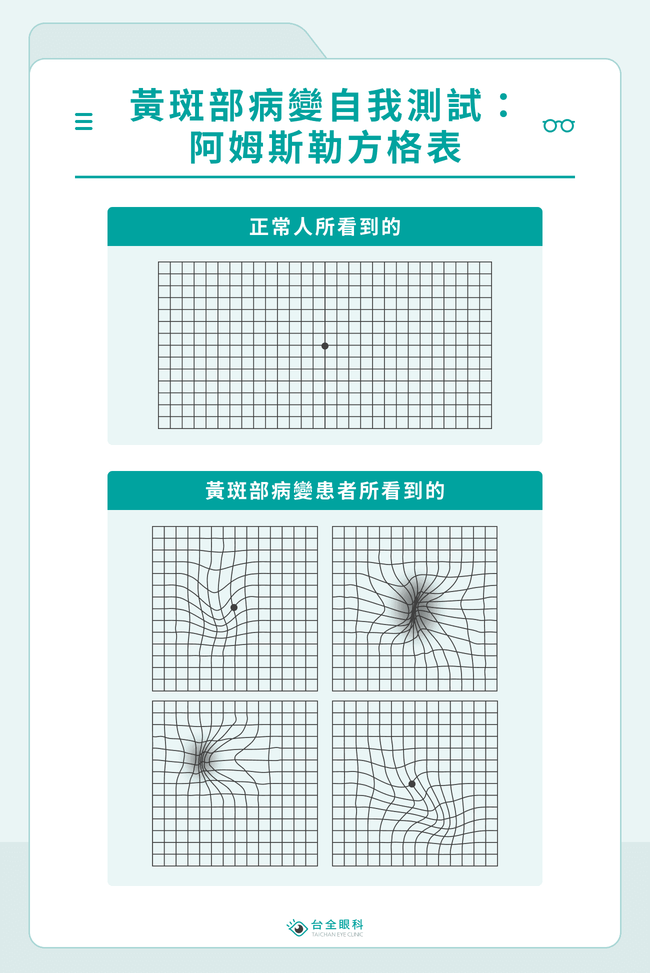 黃斑部病變自我測試：阿姆斯勒方格表