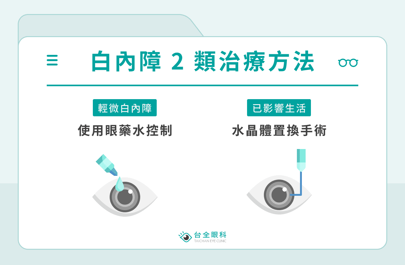 白內障治療方法