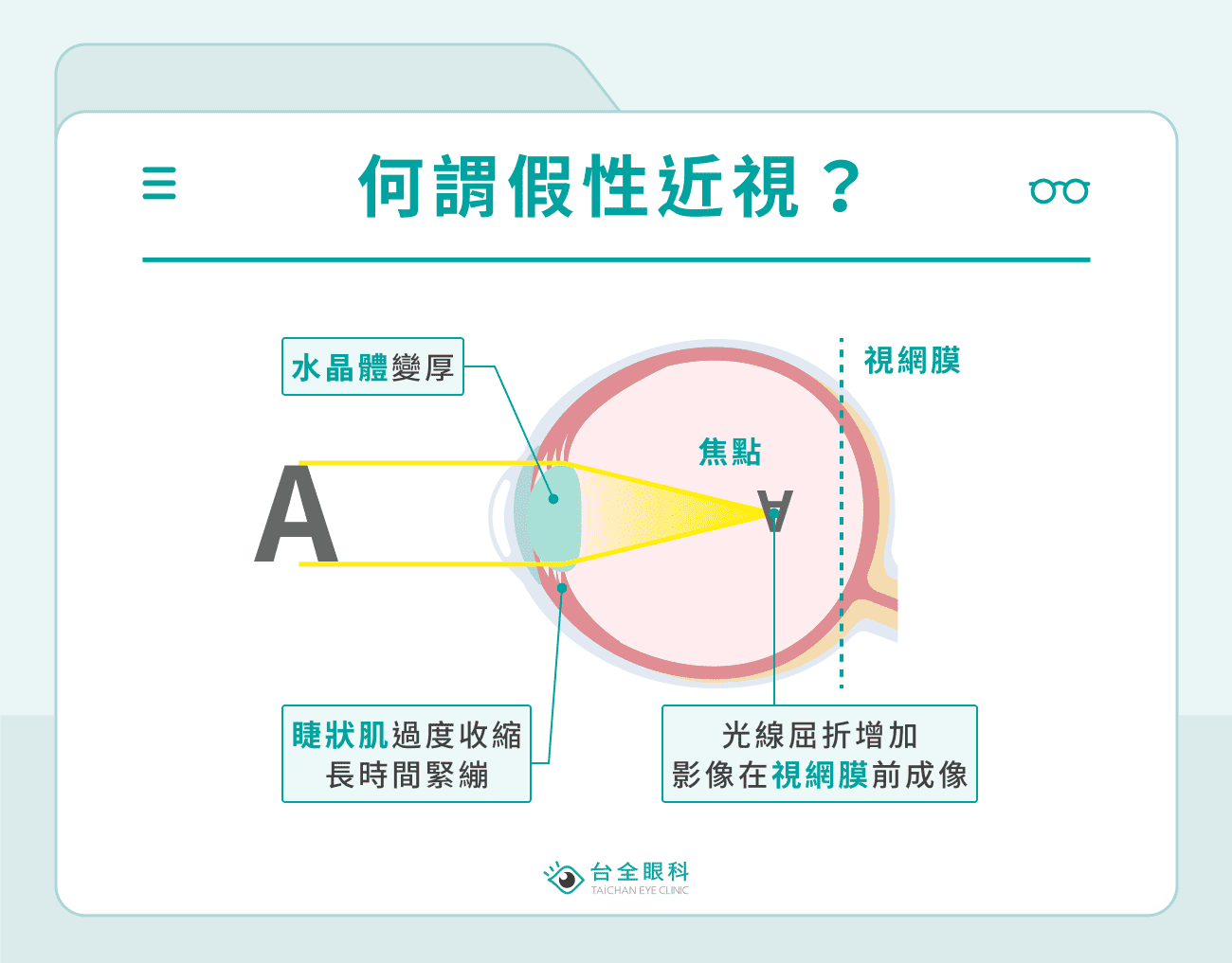 何謂假性近視？